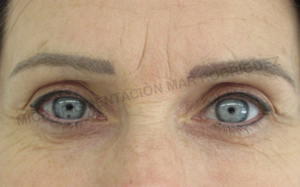 Esteticista para micropigmentación de labios en Manacor Esteticista para micropigmentación de labios en Manacor